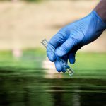 'Be vigilant' - Citizens urged following confirmed cholera cases