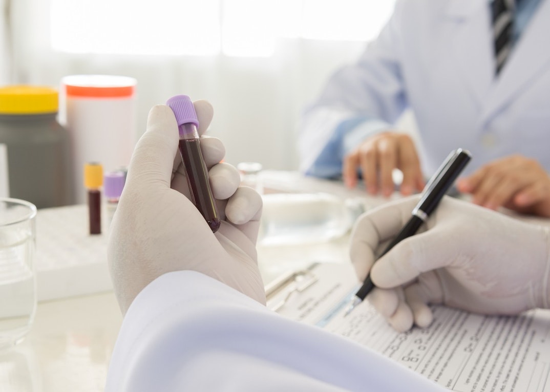 blog-lab-test