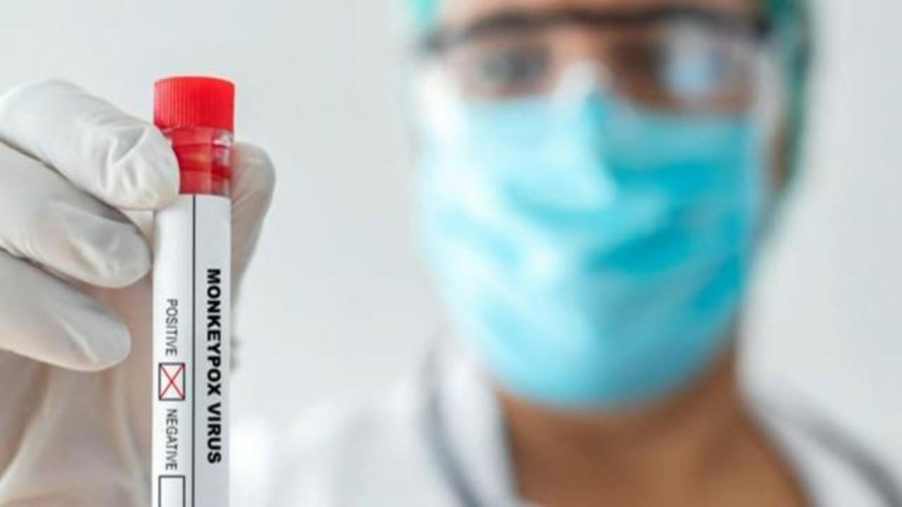 cbsn-fusion-us-health-experts-blame-lack-of-funding-and-resources-for-growing-monkeypox-outbreaks-thumbnail-1136022-640x360